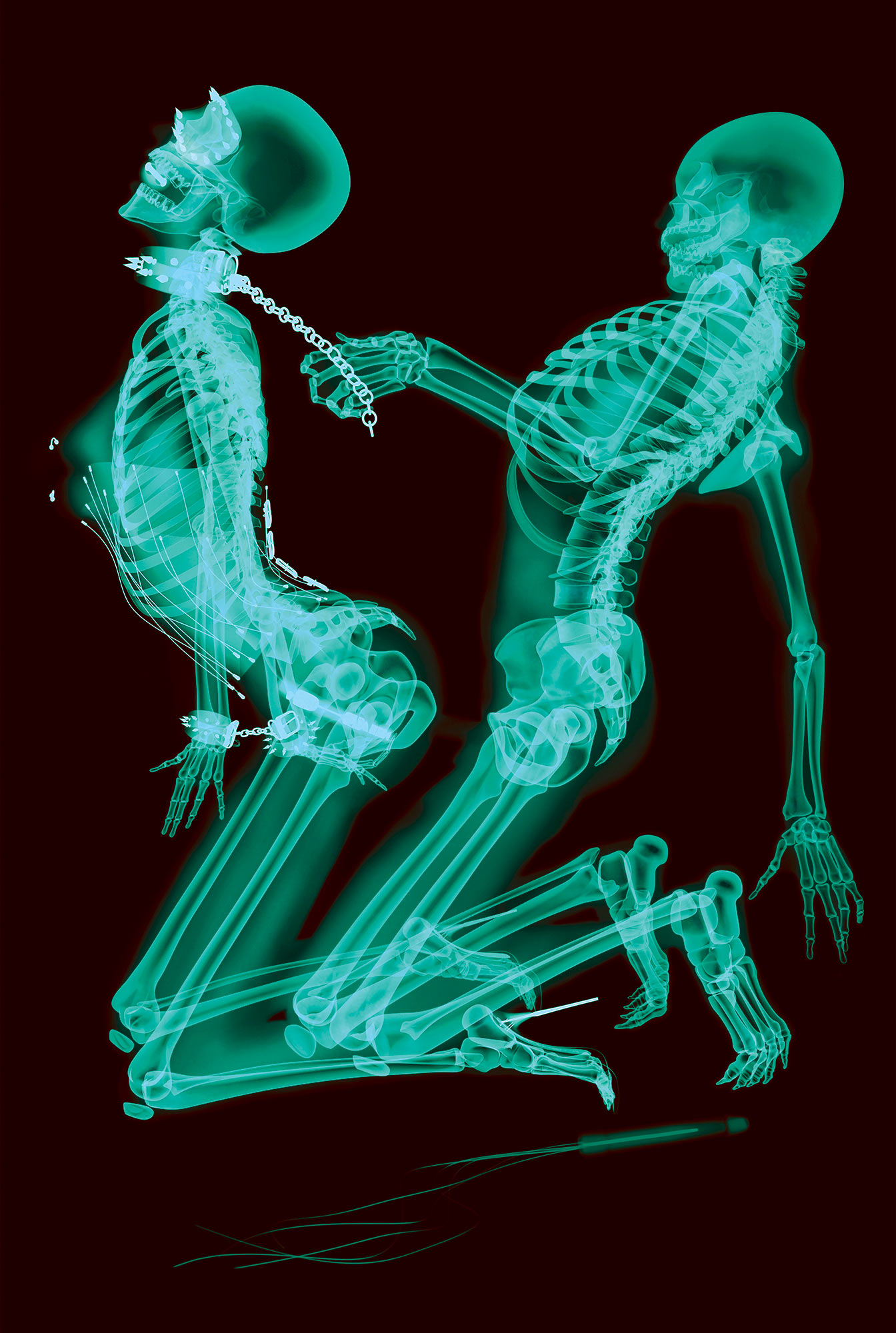 Із серії X-ray professional photo, 2011