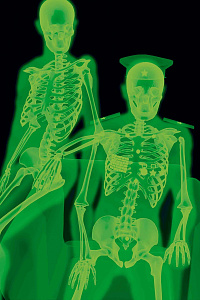  — Із серії «X-Ray: Amateur photo», 2001