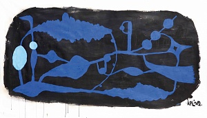 Накладные варикозные вены, 2010